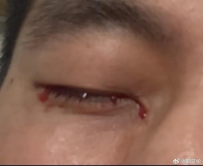 郭艾伦发声:这口气咽不下去,呼吁公开承认责