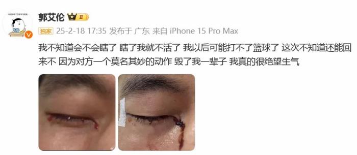 郭艾伦发声:这口气咽不下去,呼吁公开承认责