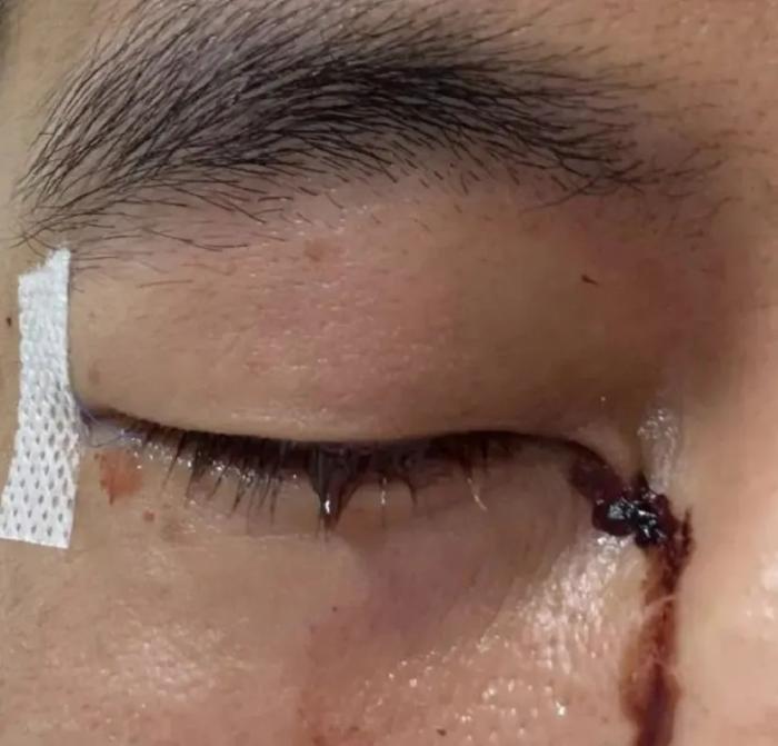 郭艾伦发声:这口气咽不下去,呼吁公开承认责